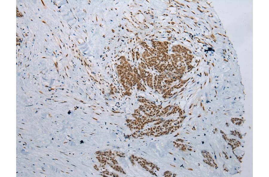 Immunohistochemistry - NSMCE2 Antibody from Signalway Antibody (43000) - Antibodies.com