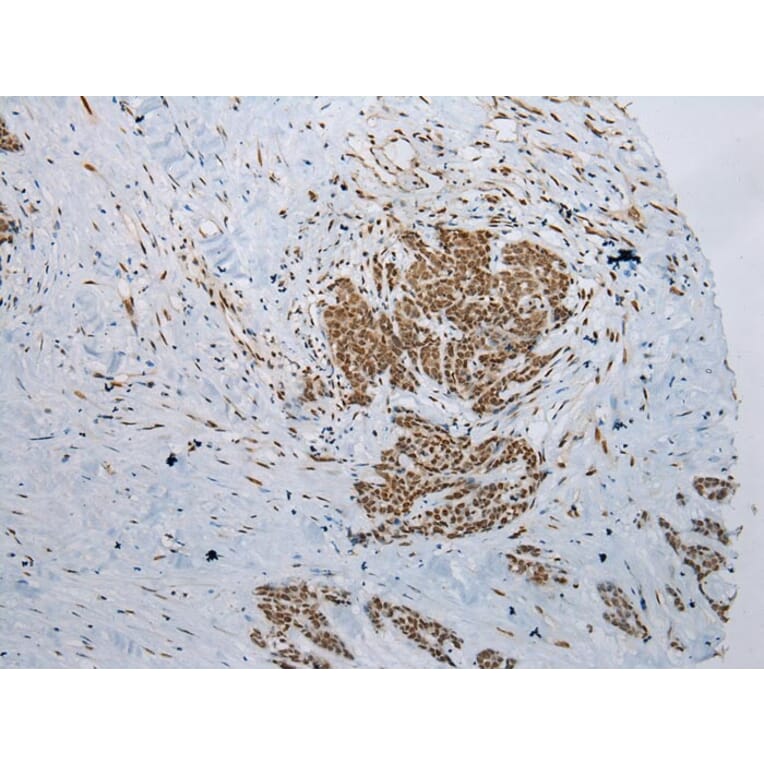 Immunohistochemistry - NSMCE2 Antibody from Signalway Antibody (43000) - Antibodies.com