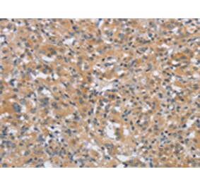 Immunohistochemistry - DTNBP1 Antibody from Signalway Antibody (43089) - Antibodies.com
