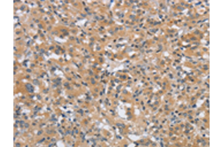 Immunohistochemistry - DTNBP1 Antibody from Signalway Antibody (43089) - Antibodies.com