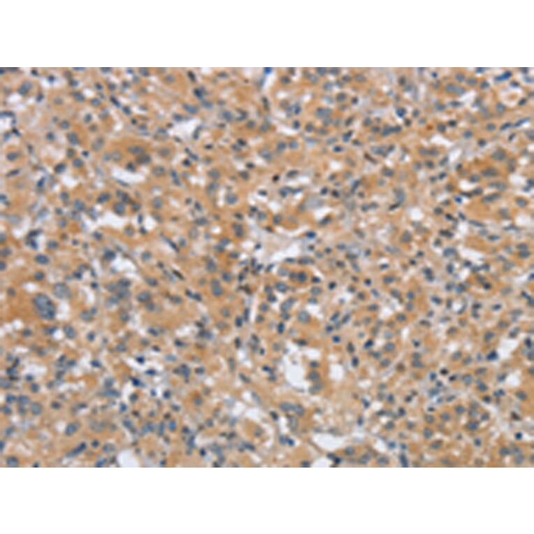 Immunohistochemistry - DTNBP1 Antibody from Signalway Antibody (43089) - Antibodies.com