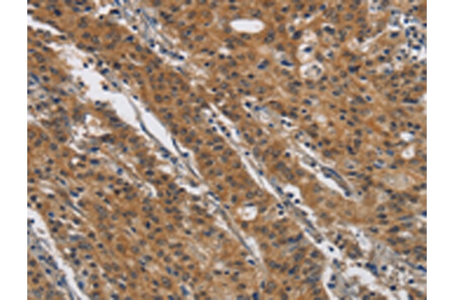 Immunohistochemistry - DTNBP1 Antibody from Signalway Antibody (43089) - Antibodies.com