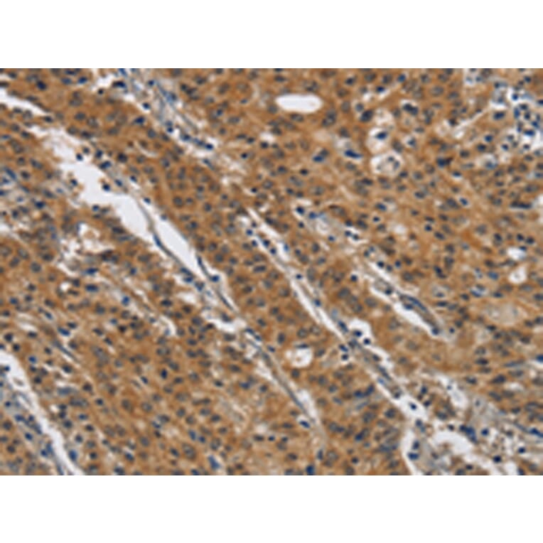 Immunohistochemistry - DTNBP1 Antibody from Signalway Antibody (43089) - Antibodies.com