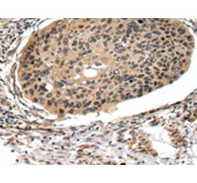 Immunohistochemistry - FOXK1 Antibody from Signalway Antibody (43090) - Antibodies.com