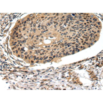Immunohistochemistry - FOXK1 Antibody from Signalway Antibody (43090) - Antibodies.com
