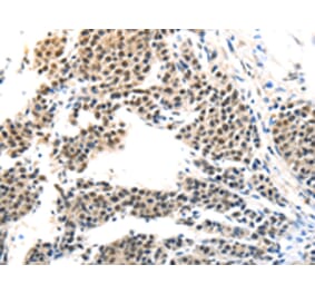 Immunohistochemistry - MAGEA6 Antibody from Signalway Antibody (43096) - Antibodies.com