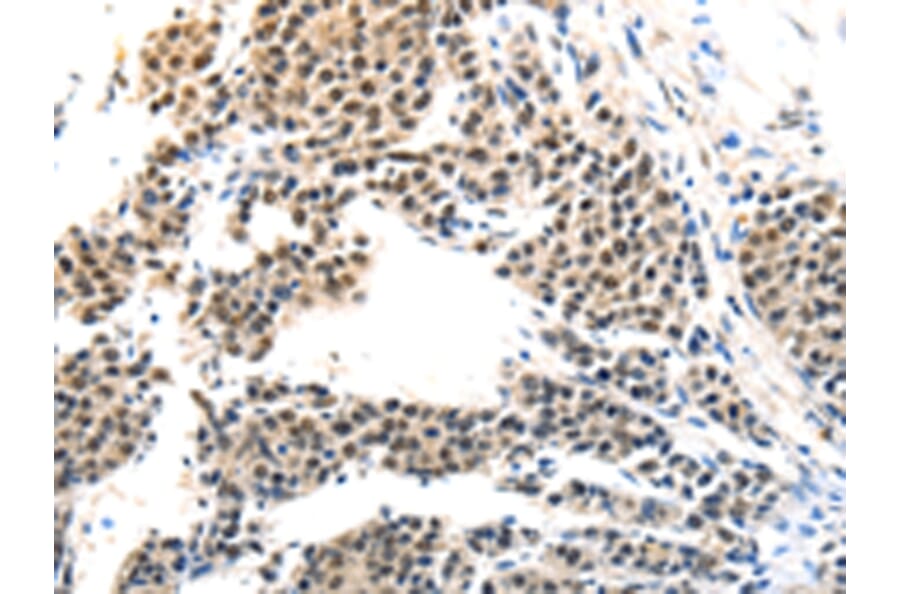 Immunohistochemistry - MAGEA6 Antibody from Signalway Antibody (43096) - Antibodies.com
