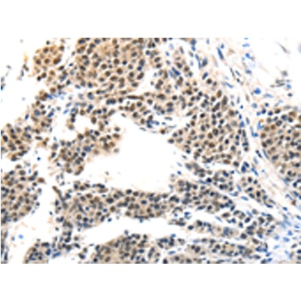 Immunohistochemistry - MAGEA6 Antibody from Signalway Antibody (43096) - Antibodies.com