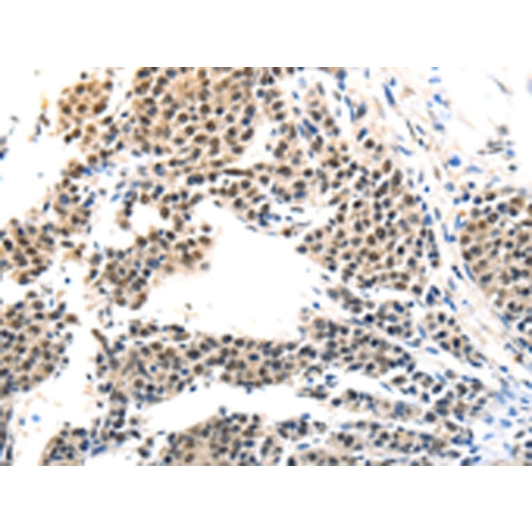 Immunohistochemistry - MAGEA6 Antibody from Signalway Antibody (43096) - Antibodies.com