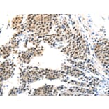 Immunohistochemistry - MAGEA6 Antibody from Signalway Antibody (43096) - Antibodies.com