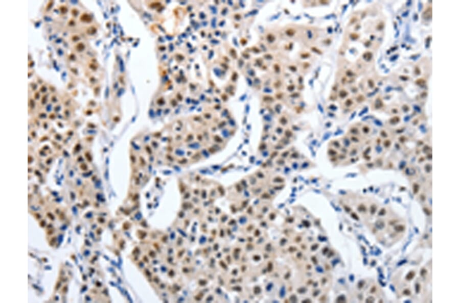 Immunohistochemistry - MAGEA6 Antibody from Signalway Antibody (43096) - Antibodies.com