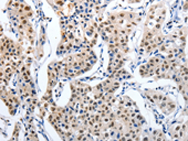 Immunohistochemistry - MAGEA6 Antibody from Signalway Antibody (43096) - Antibodies.com
