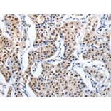 Immunohistochemistry - MAGEA6 Antibody from Signalway Antibody (43096) - Antibodies.com