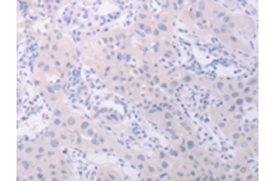 Immunohistochemistry - PKD2L1 Antibody from Signalway Antibody (43099) - Antibodies.com