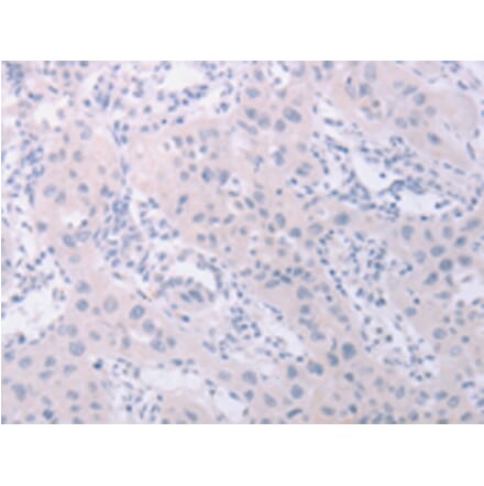 Immunohistochemistry - PKD2L1 Antibody from Signalway Antibody (43099) - Antibodies.com