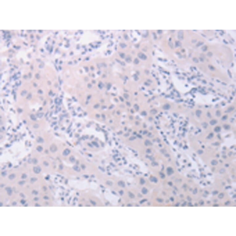 Immunohistochemistry - PKD2L1 Antibody from Signalway Antibody (43099) - Antibodies.com