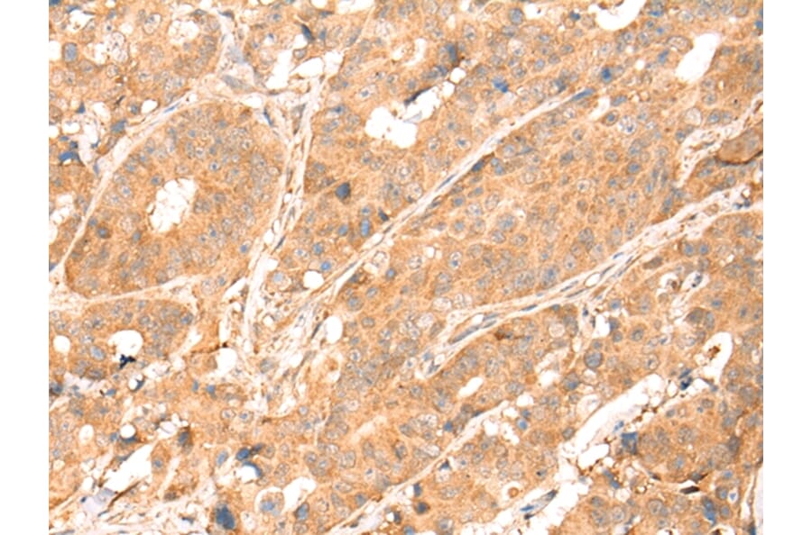 Immunohistochemistry - ABCA10 Antibody from Signalway Antibody (43112) - Antibodies.com