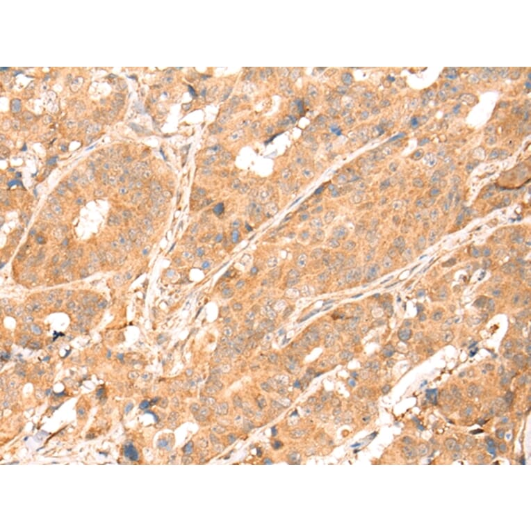 Immunohistochemistry - ABCA10 Antibody from Signalway Antibody (43112) - Antibodies.com