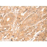 Immunohistochemistry - ABCA10 Antibody from Signalway Antibody (43112) - Antibodies.com