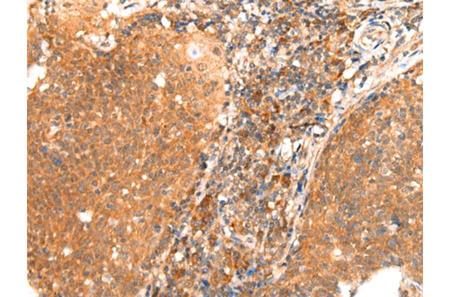Immunohistochemistry - ABCA10 Antibody from Signalway Antibody (43112) - Antibodies.com