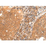 Immunohistochemistry - ABCA10 Antibody from Signalway Antibody (43112) - Antibodies.com
