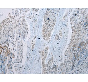 Immunohistochemistry - TADA2A Antibody from Signalway Antibody (43114) - Antibodies.com