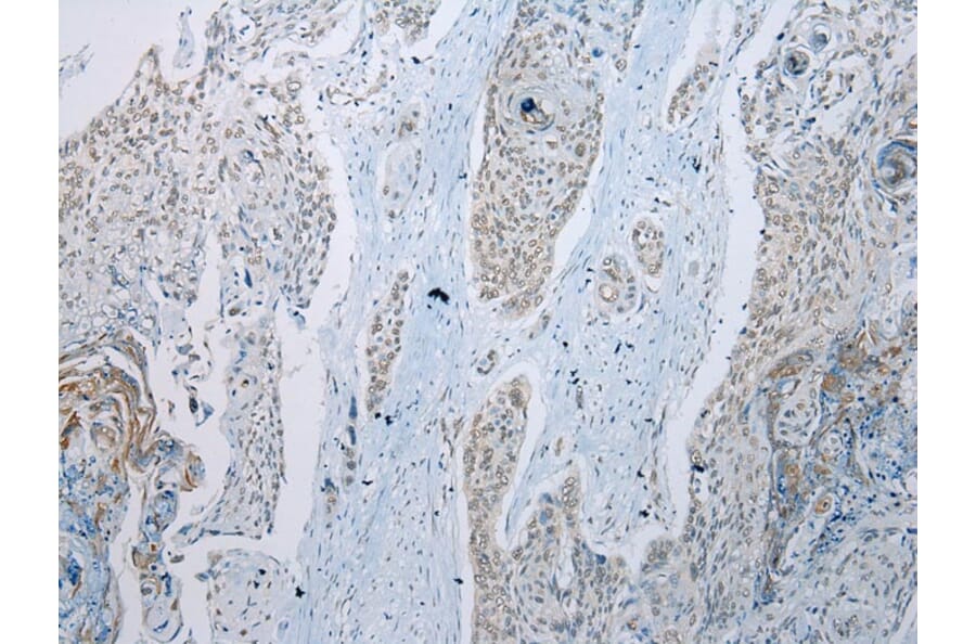 Immunohistochemistry - TADA2A Antibody from Signalway Antibody (43114) - Antibodies.com
