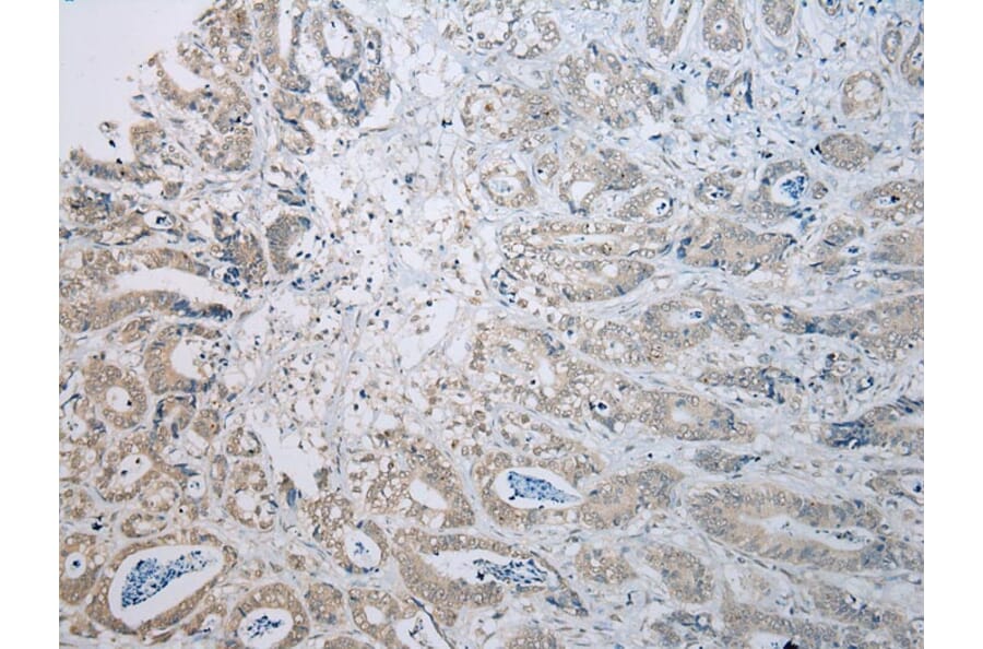 Immunohistochemistry - TADA2A Antibody from Signalway Antibody (43114) - Antibodies.com