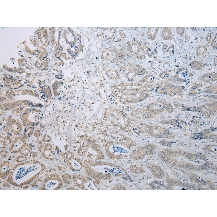 Immunohistochemistry - TADA2A Antibody from Signalway Antibody (43114) - Antibodies.com