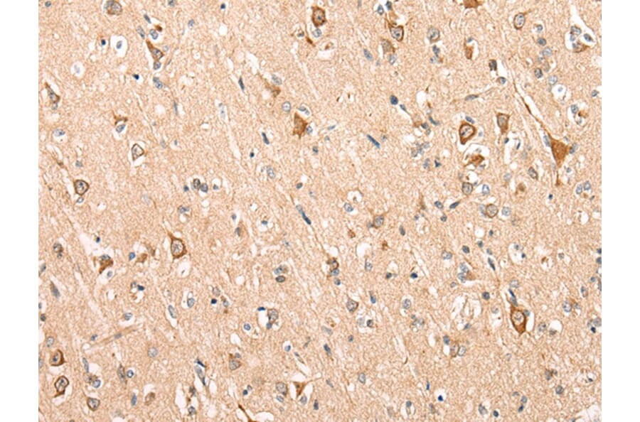 Immunohistochemistry - ADAM19 Antibody from Signalway Antibody (43115) - Antibodies.com