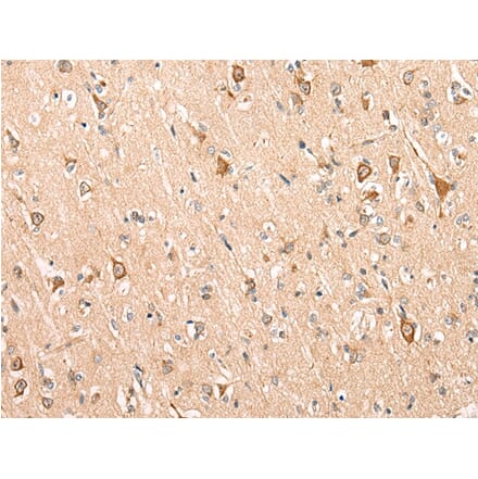 Immunohistochemistry - ADAM19 Antibody from Signalway Antibody (43115) - Antibodies.com