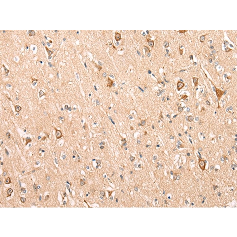 Immunohistochemistry - ADAM19 Antibody from Signalway Antibody (43115) - Antibodies.com