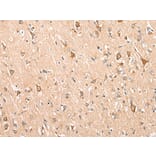 Immunohistochemistry - ADAM19 Antibody from Signalway Antibody (43115) - Antibodies.com