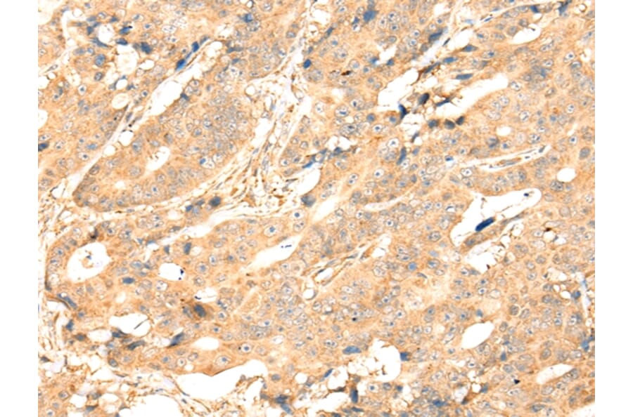 Immunohistochemistry - ADAM19 Antibody from Signalway Antibody (43115) - Antibodies.com