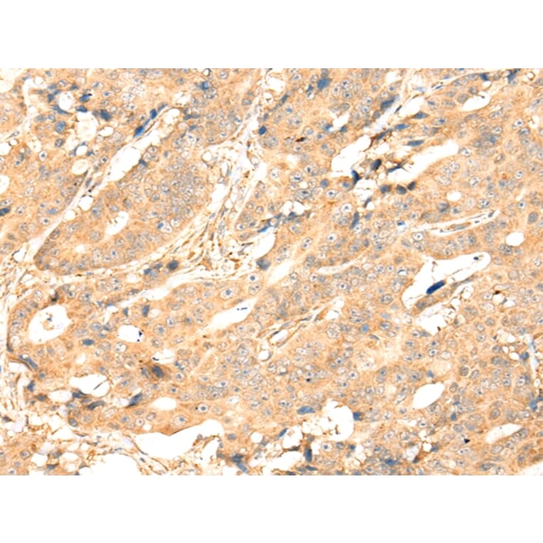 Immunohistochemistry - ADAM19 Antibody from Signalway Antibody (43115) - Antibodies.com