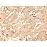 Immunohistochemistry - ADAM19 Antibody from Signalway Antibody (43115) - Antibodies.com