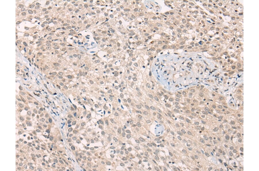 Immunohistochemistry - ADORA1 Antibody from Signalway Antibody (43117) - Antibodies.com