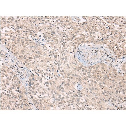 Immunohistochemistry - ADORA1 Antibody from Signalway Antibody (43117) - Antibodies.com