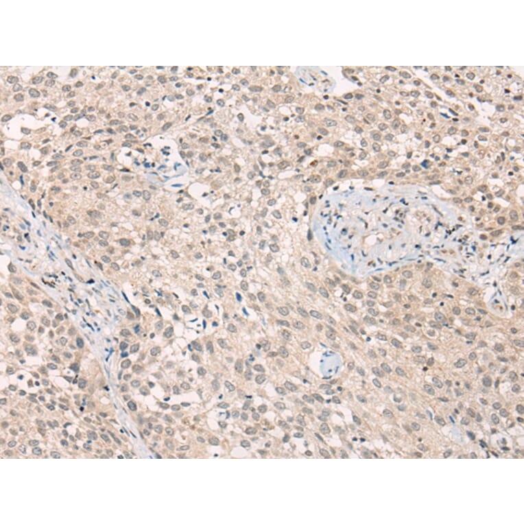 Immunohistochemistry - ADORA1 Antibody from Signalway Antibody (43117) - Antibodies.com