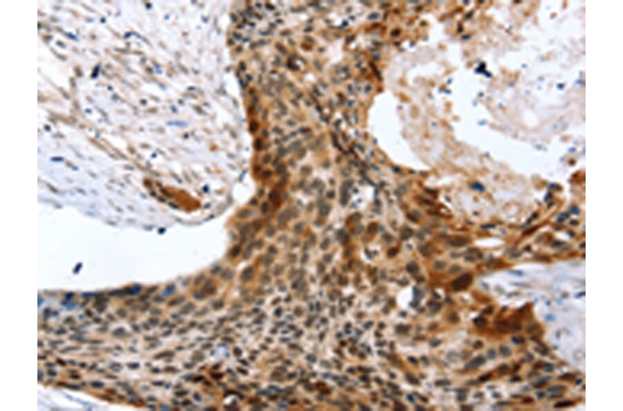 Immunohistochemistry - SYNPO2 Antibody from Signalway Antibody (43152) - Antibodies.com