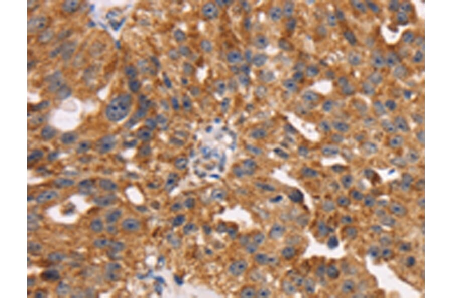 Immunohistochemistry - TM4SF1 Antibody from Signalway Antibody (43153) - Antibodies.com