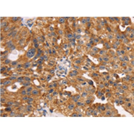 Immunohistochemistry - TM4SF1 Antibody from Signalway Antibody (43153) - Antibodies.com