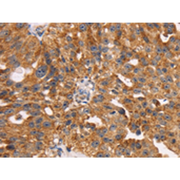 Immunohistochemistry - TM4SF1 Antibody from Signalway Antibody (43153) - Antibodies.com
