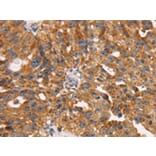 Immunohistochemistry - TM4SF1 Antibody from Signalway Antibody (43153) - Antibodies.com