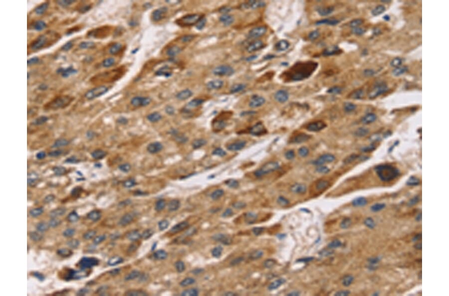 Immunohistochemistry - TM4SF1 Antibody from Signalway Antibody (43153) - Antibodies.com