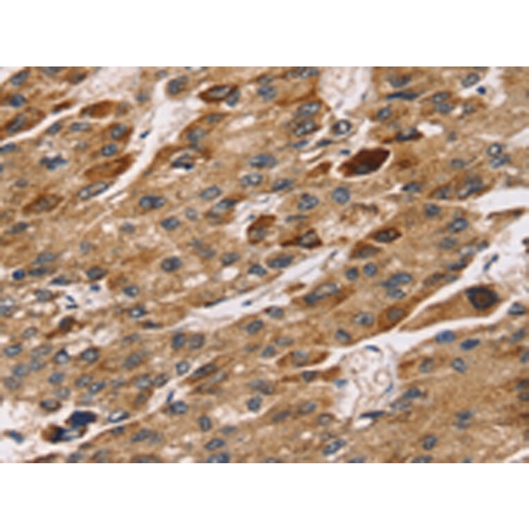 Immunohistochemistry - TM4SF1 Antibody from Signalway Antibody (43153) - Antibodies.com