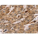 Immunohistochemistry - TM4SF1 Antibody from Signalway Antibody (43153) - Antibodies.com