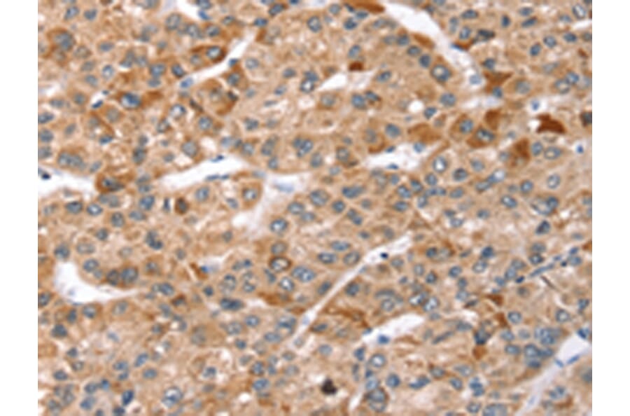 Immunohistochemistry - TBC1D1 Antibody from Signalway Antibody (43157) - Antibodies.com