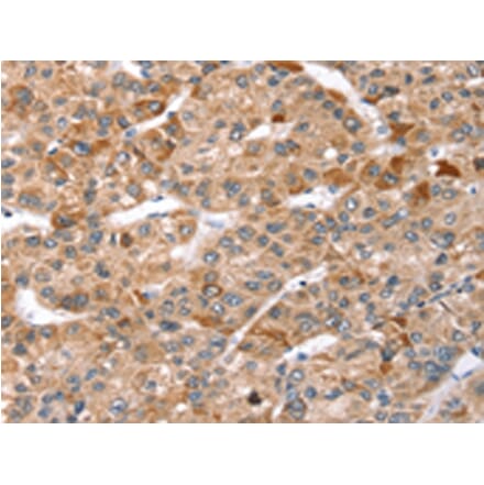 Immunohistochemistry - TBC1D1 Antibody from Signalway Antibody (43157) - Antibodies.com