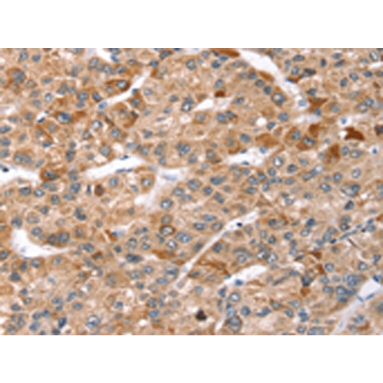 Immunohistochemistry - TBC1D1 Antibody from Signalway Antibody (43157) - Antibodies.com
